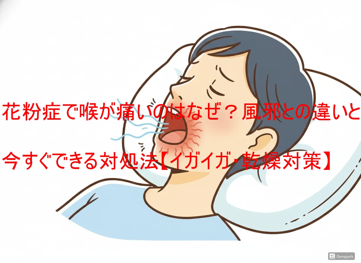 花粉症で喉が痛いのはなぜ？風邪との違いと今すぐできる対処法【イガイガ・乾燥対策】